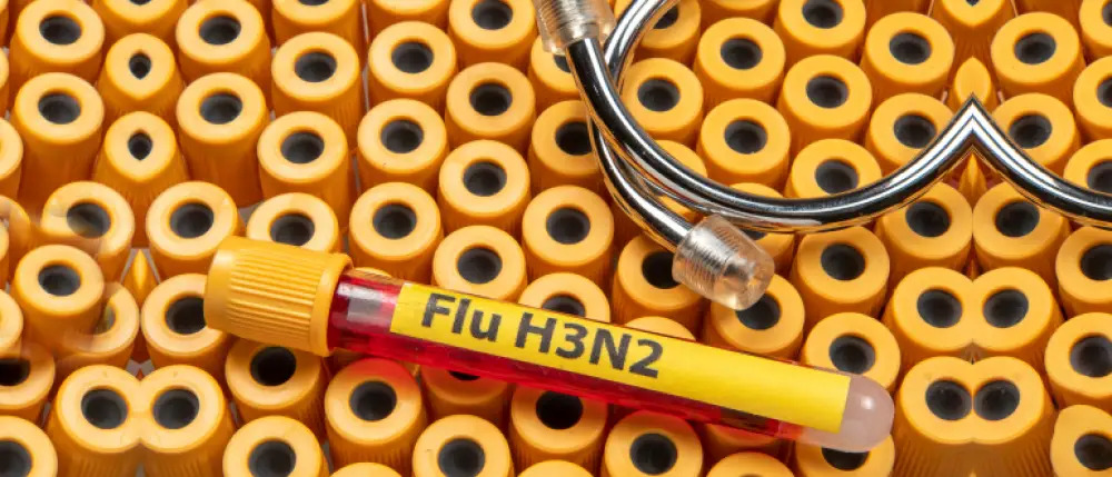 उत्तराखंड में H3N2 वायरस की दस्तक, दो माह में 12 मामले पॉजिटिव उत्तराखंड में H3N2 वायरस की दस्तक, दो माह में 12 मामले पॉजिटिव